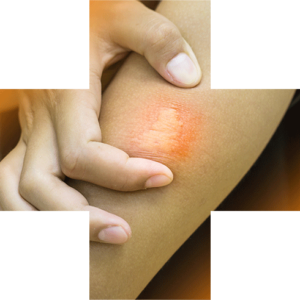 Do Not Disturb | Stinging Insect Education